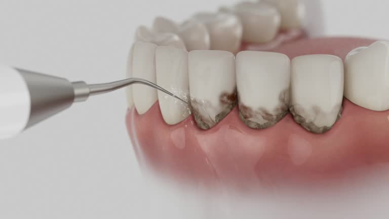 Reliable Dental Implants contractor in Sisseton, SD by Smile Center Dentistry